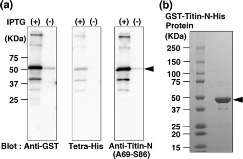 Preparation of human Titin-N fragment protein. (a) The GST-and ...