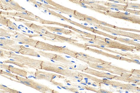 N Cadherin Antibody 22018 1 AP Proteintech