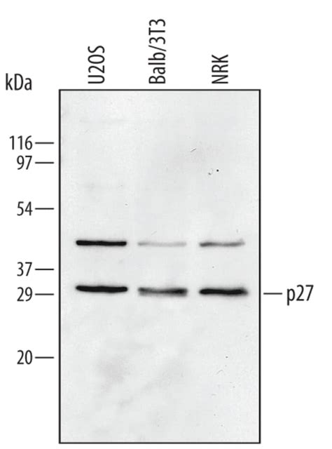 Humanmouserat P27kip1 Antibody Randd Systems™ 100ug Unlabeled