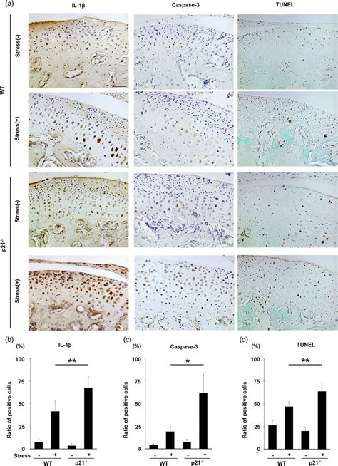 Immunohistochemical Analysis Of Phosphorylated Interleukin Il ‐1β And