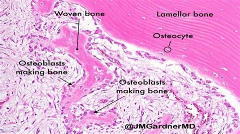 Periodontal Ligament Histology