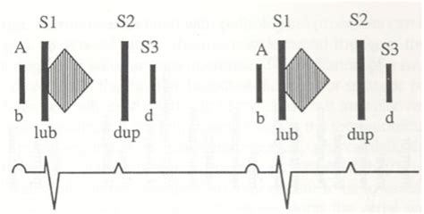 Cardiac murmurs Flashcards | Quizlet