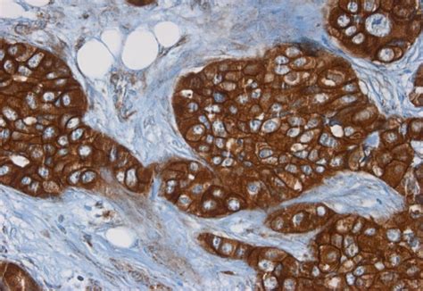 Ihc Plus™ Erbb2 Her2 Monoclonal Antibody Mouse Anti Human Lsbio