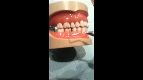 Perio Probing Posterior Maxillary Right Buccals Youtube