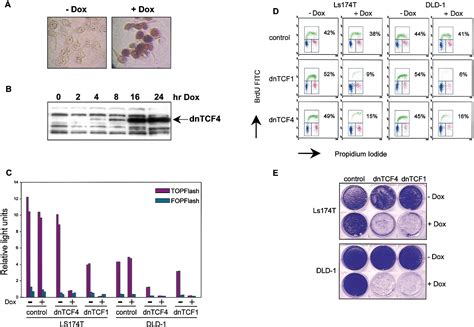 The β Catenin Tcf 4 Complex Imposes A Crypt Progenitor Phenotype On