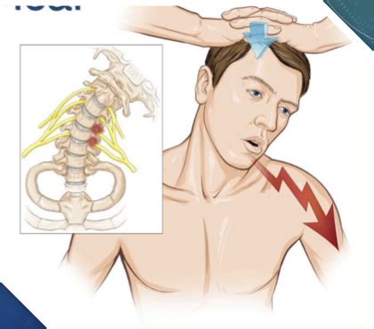 Clin Skills MSK Flashcards Quizlet