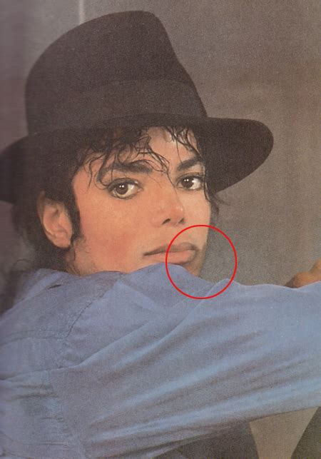 || The Vitiligo Proof || - Michael Jackson Photo (32272055) - Fanpop