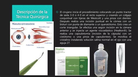 Facoemulsificaci N De Catarata Y Vitrectomia Anterior Ppt Descarga