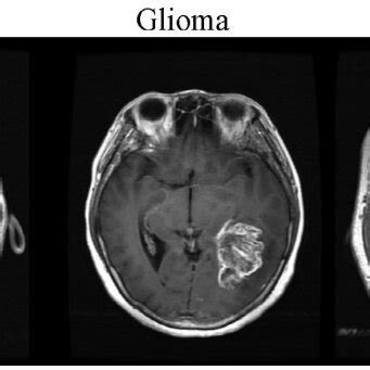 Sample images of 3 different tumor types [12] | Download Scientific Diagram