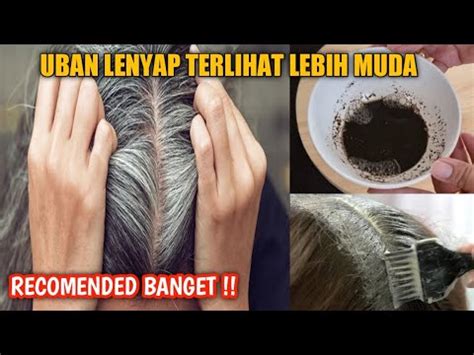 10 CARA AMPUH HILANGKAN UBAN DENGAN BAHAN AMAN DAN ALAMI YouTube