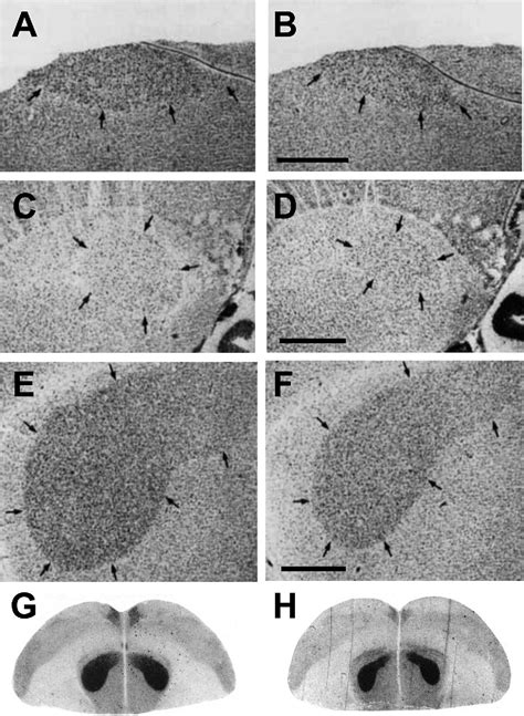 Figure 2 From Sex Differences And Similarities In The Neural Circuit