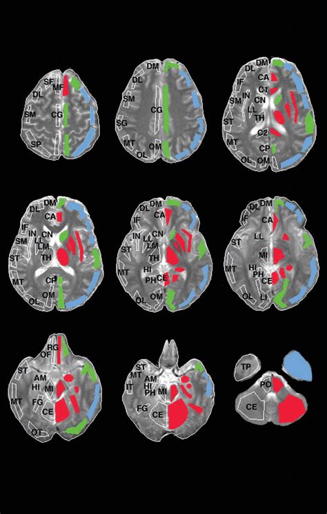 Figure 1 From Regional Differences In The Coupling Between Resting