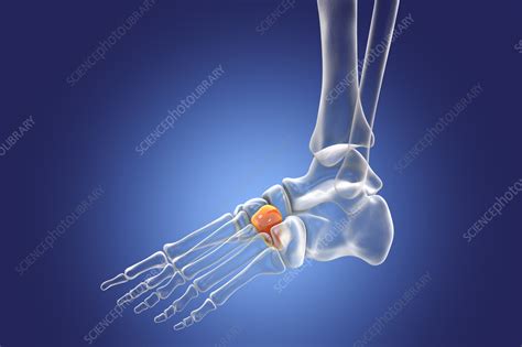 Lateral cuneiform bone, illustration - Stock Image - F036/8576 - Science Photo Library