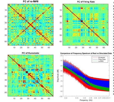 Comparison Of The Average Functional Connectivity Between The Rs Fmri