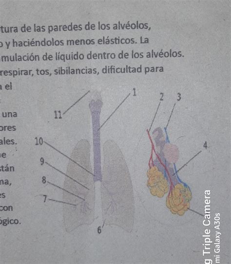 Quien Me Puede Decir Los Nombres De Estas Partes Porfa Doy Coronita