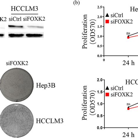 Foxk Downregulation Inhibits Cell Growth And Colony Formation In Hep B