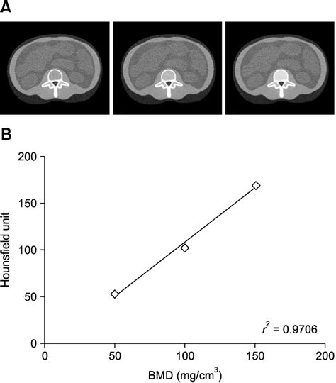 The Method Of Conversion Of The Hounsfield Units Hu Value To Bone Download Scientific Diagram