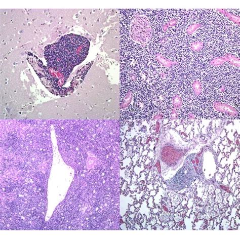 Histological Examination After Hematoxylin And Eosin Staining