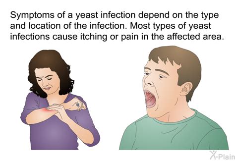 PatEdu.com : Yeast Infections