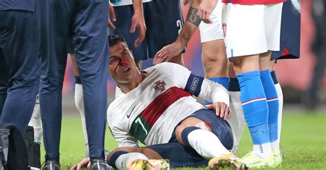 Cristiano Ronaldo suffers bloody injury in 4-0 Portugal win - Futbol on FanNation