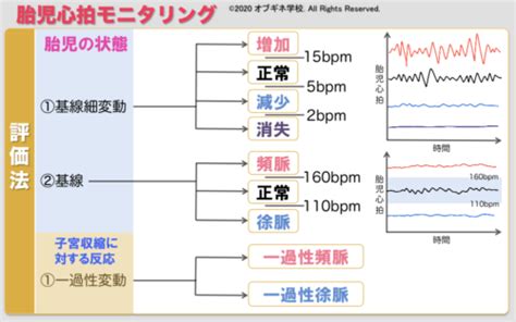 胎児心拍モニタリング編1 新しい切り口の産婦人科学講座│見えてくる産婦人科学 オブギネ学校