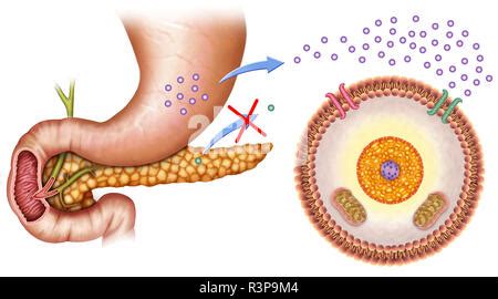 Illustration Of Insulin And Glucose Production In Type 2 Diabetes