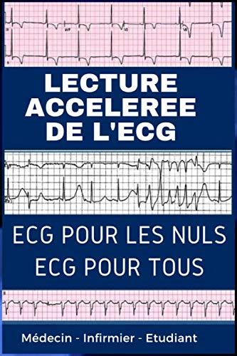 Lecture Acceleree De L Ecg ECG Pour Les Nuls ECG Pour Tous Comprendre