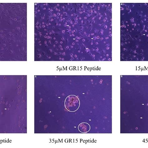 Influence Of Gr15 Peptide Alteration On Cellular Morphology In Mcf 7 Download Scientific