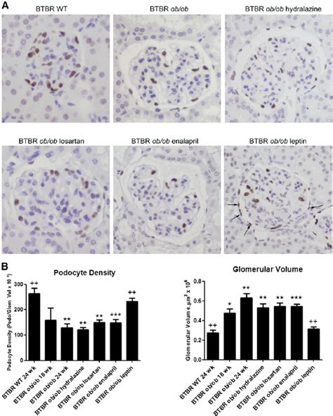 Btbr Ob Ob Mice With Leptin Replacement Demonstrate Replenished