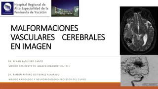 Malformaciones Arterio Venosas Cerebrales PPT