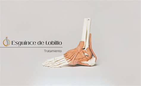 Esguince De Tobillo Vicente Magdalena Fisioterapia Y Osteopat A En