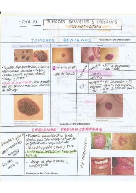 Tumores Benignos Y Lesiones Precancerosas DERMA Dra Odalis Moreno