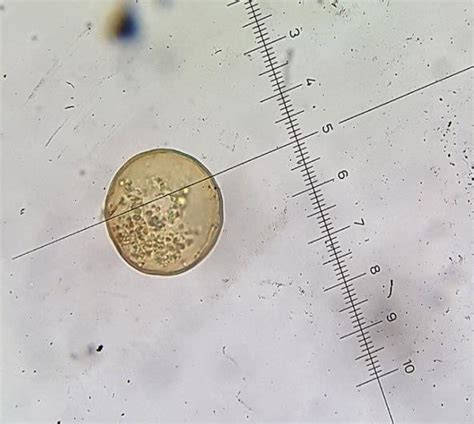 Entamoeba Coli