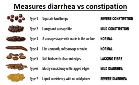 Large intestine diseases Flashcards | Quizlet