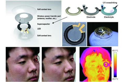 A contact lens that can show when blood glucose levels are high