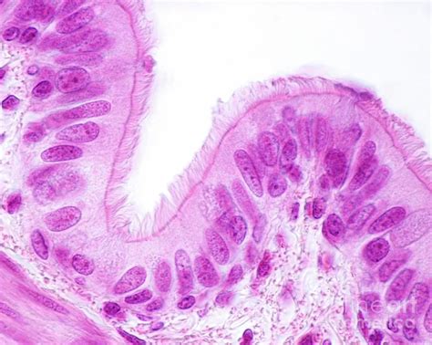 Respiratory Epithelium By Science Photo Library