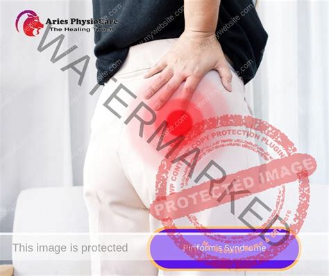 Piriformis Syndrome Aries Physiocare