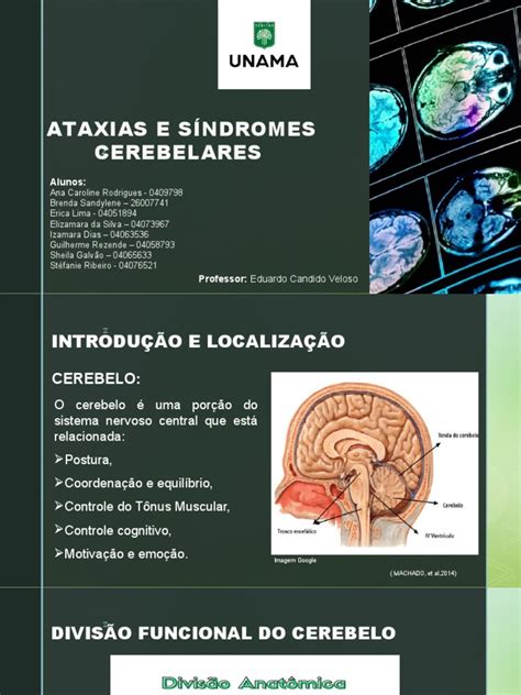Ataxias e Síndromes Cerebelares | PDF | Cerebelo | Medicina Clínica