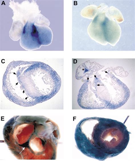 Developmental Pattern Of Hf B Expression In Embryonic Mouse Heart As