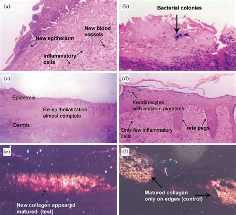 Histology Of Wound Sections Stained With Hematoxylin And Eosin