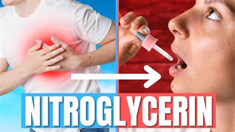 Nitroglycerin Uses Side Effects Safety Doctor Explains YouTube