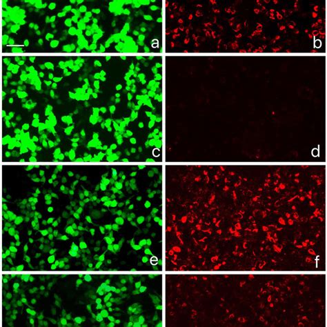 GFAPα IgG test results by GFAP transfected HEK293 cell based