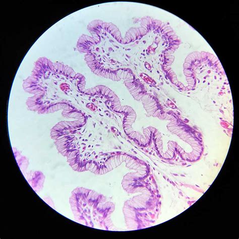 Human Cervix Section Prepared Slides 7 µm Sec Hande Stain Wholesale