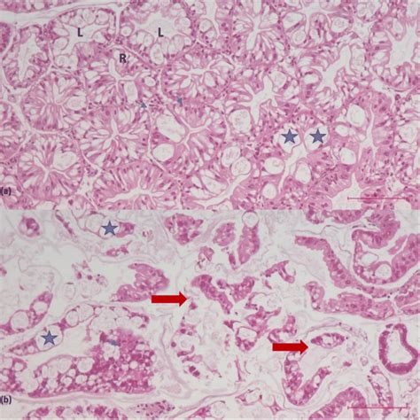 Hepatopancreas Tissue A Histological Appearance Of Normal Tubules L