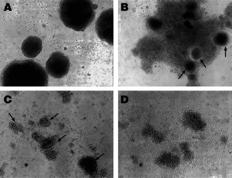 Effect of culture conditions on syncytium formation in B lymphocytes ...