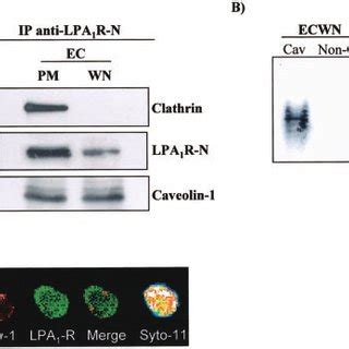 Co Localization Of Lpa R And Caveolin In Pcmvec Nuclei A