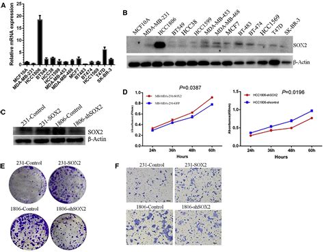 Sox2 Promotes Brain Metastasis Of Breast Cancer By Upregulating The