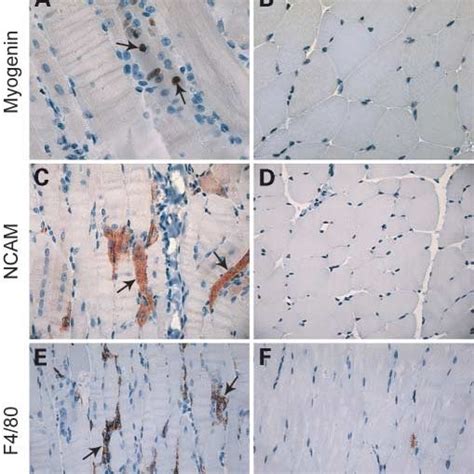 Gene Expression Comparison By Microarray Of Adam Transgenic Mice And