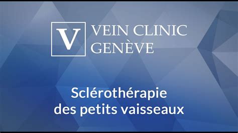 Vein Clinic Sclerotherapie Petits Vaisseaux Youtube