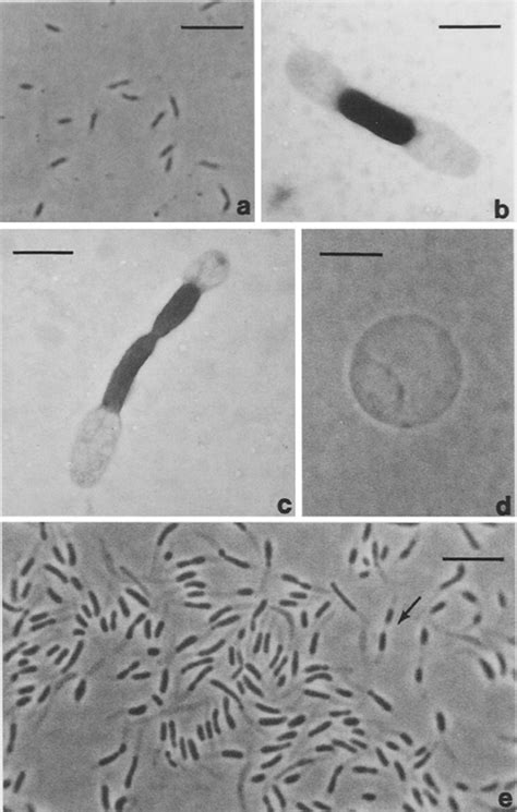 Phase Contrast Micrographs A D E And Electron Micrographs B C Of